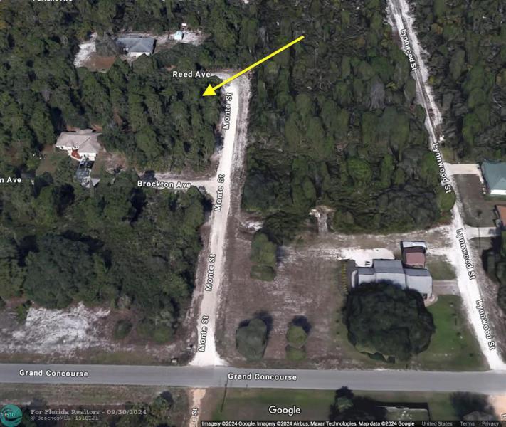 Duplex, Triplex and Fourplex Images